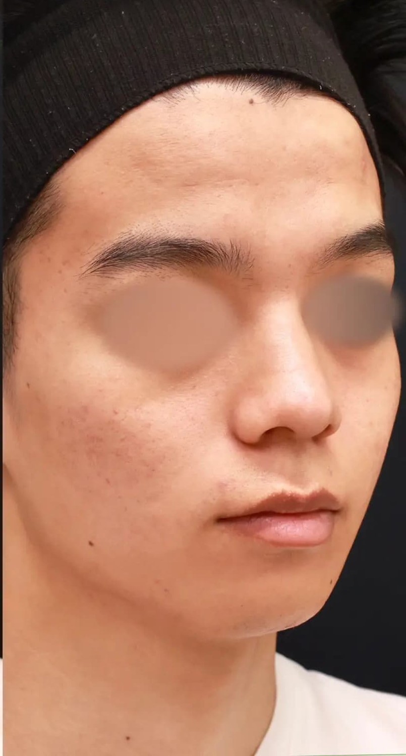 Después
